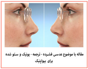 مقاله نویسی باموضوع عدسی فشرده عینک - بینا اپتیک